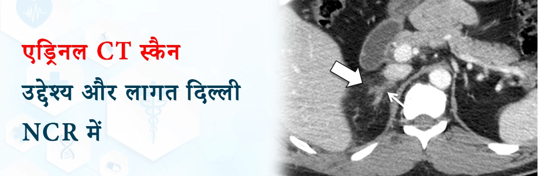 एड्रिनल CT स्कैन: उद्देश्य और लागत दिल्ली NCR में